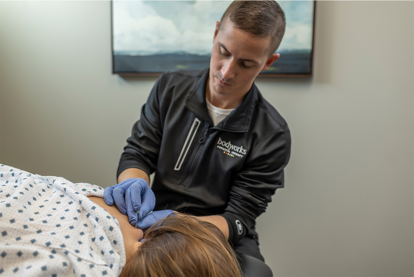 Dry Needling
